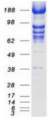 Coomassie blue staining of purified TACC3 protein.